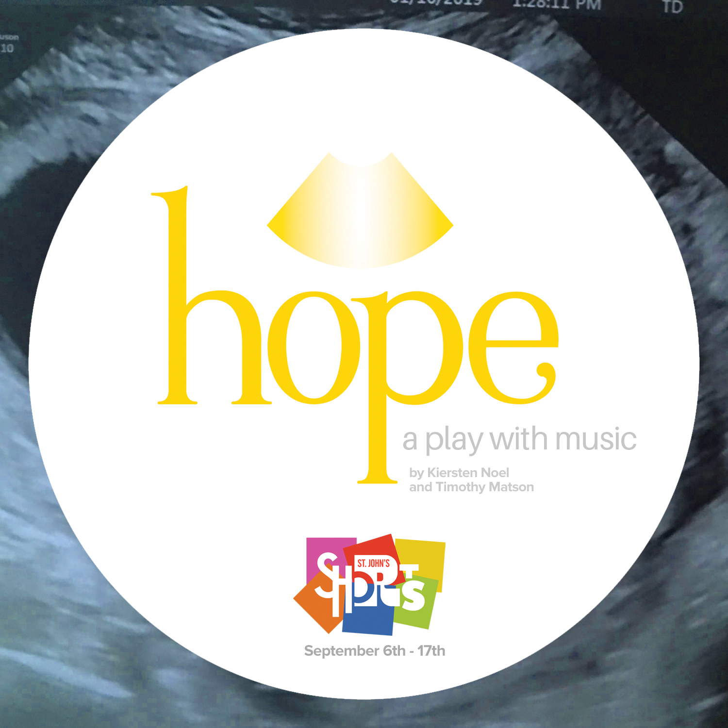 An ultrasound cone is overlaid with a white circle, where text reads
hope
a play with music
by Kiersten Noel and Timothy Matson
St. John's Shorts, September 6th-17th
